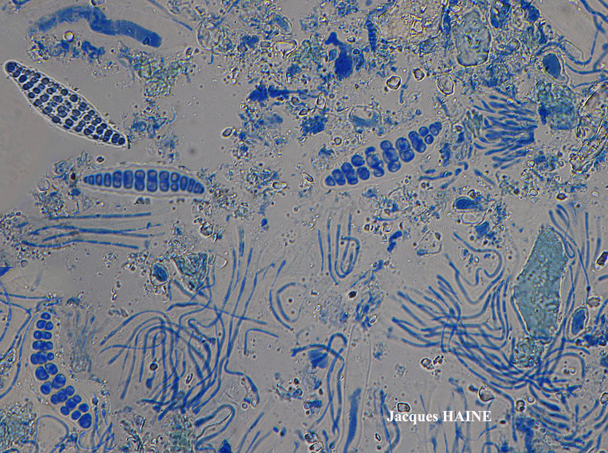 Thelotrema macrosporum P.M. Jørg & P. James